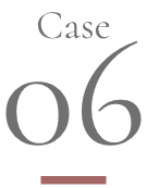 医療用ウィッグ一覧